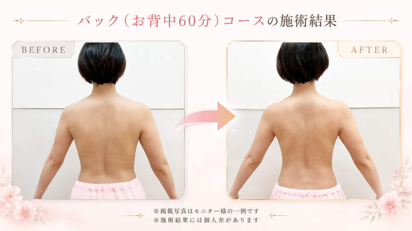 バック（お背中60分）コースのご紹介